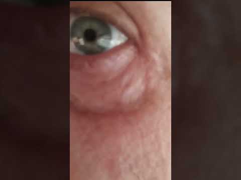Depoimento em vídeo - Vision Prime