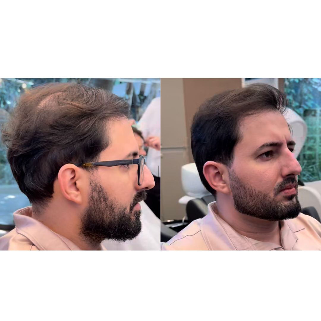 Transformação