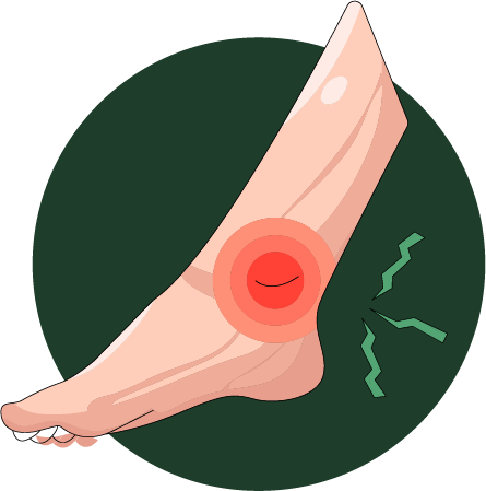 Sock-Mark Noticers
