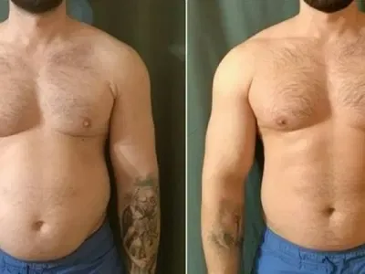 William Davis transformation