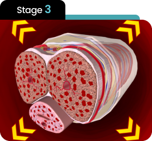Stage 3 — Held, Not Just Started