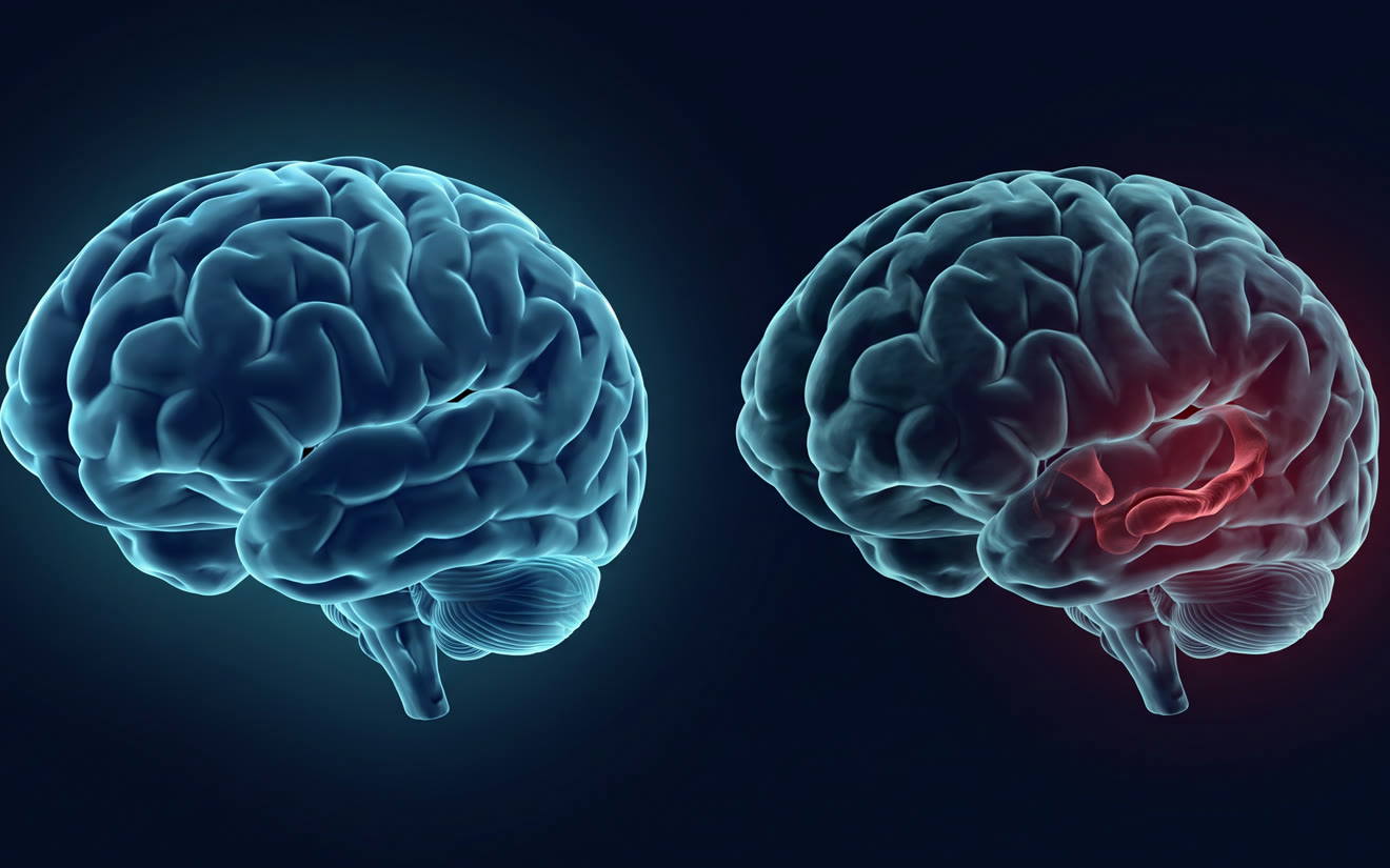 Illustration of two brains side by side