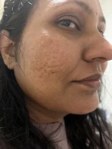 Experiencia de María con Praquel