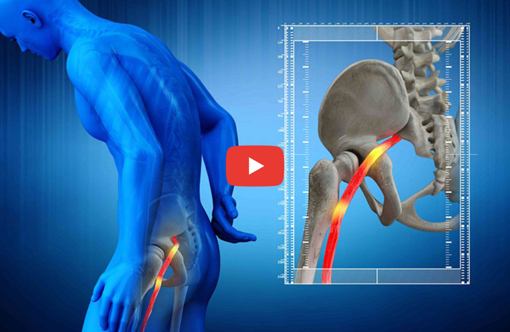 imag-sciatica-pain-relief