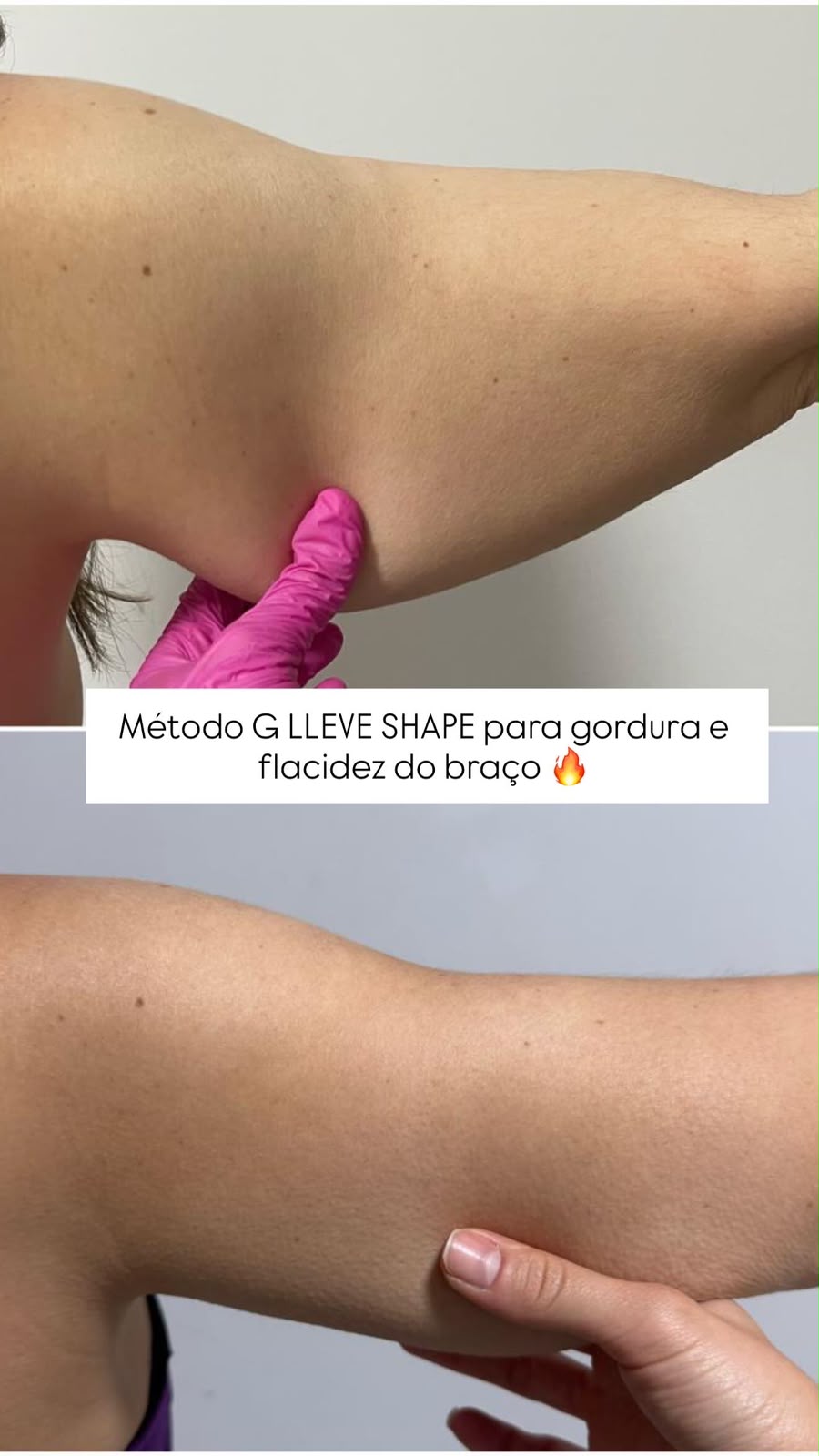 G LLEVE SHAPE