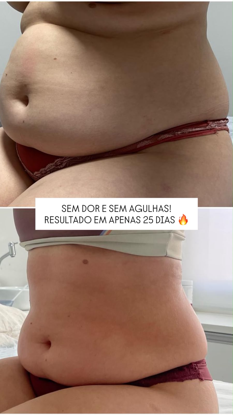 G LLEVE SHAPE
