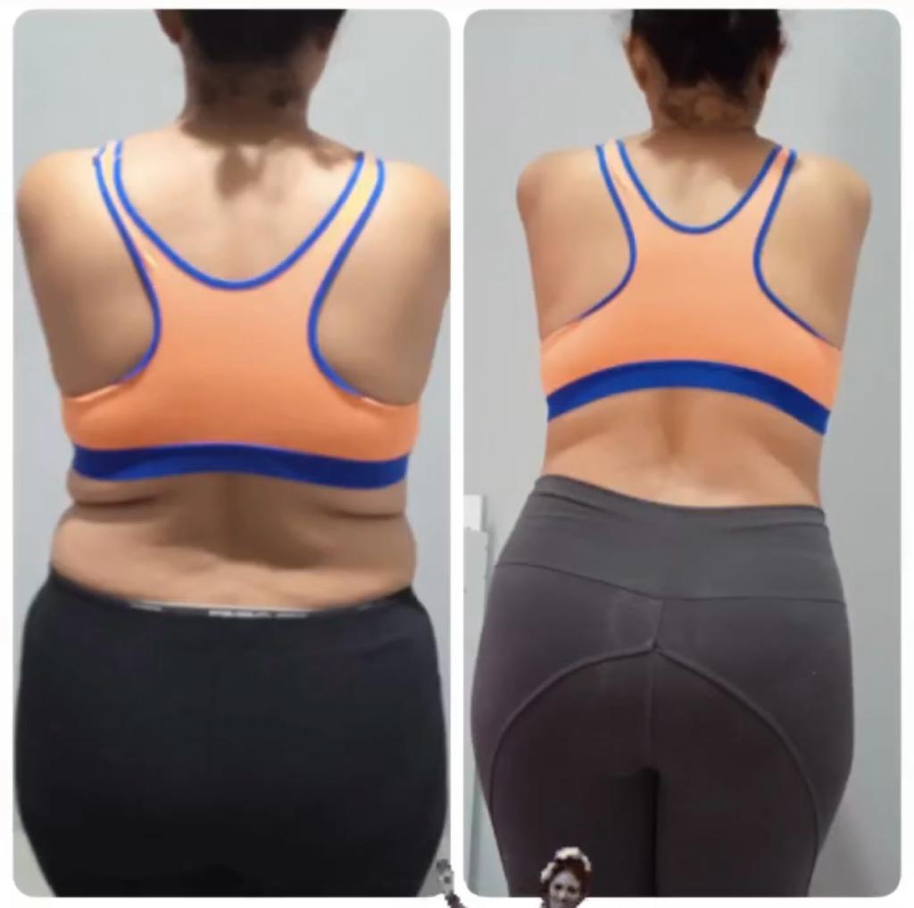 Antes e depois de cliente que usou o Efeito 36