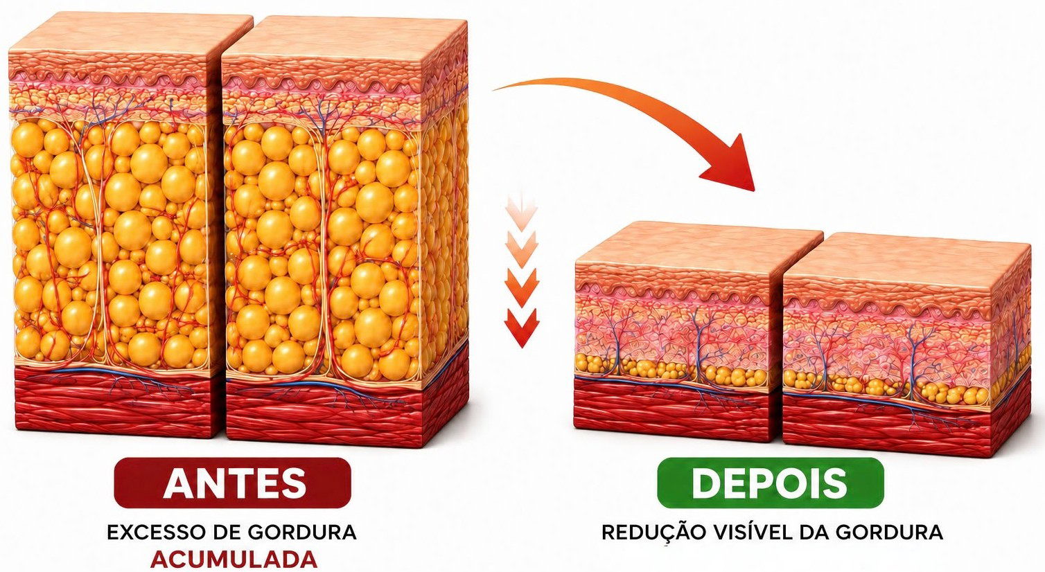 Antes e depois da camada de gordura