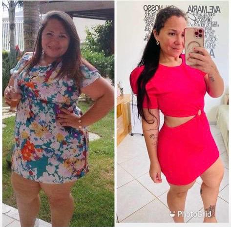 Antes e depois de cliente que usou o Efeito 36