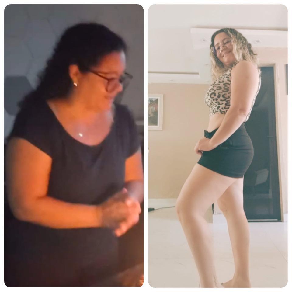Antes e depois de cliente que usou o Efeito 36