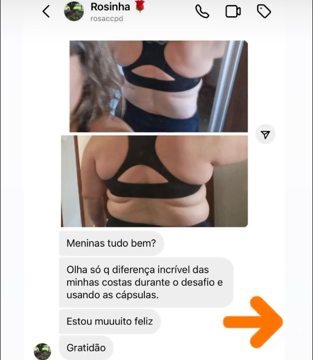 Cliente enviou foto das costas mostrando a diferença