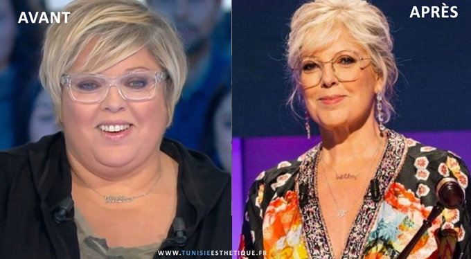 Laurence Boccolini avant / après