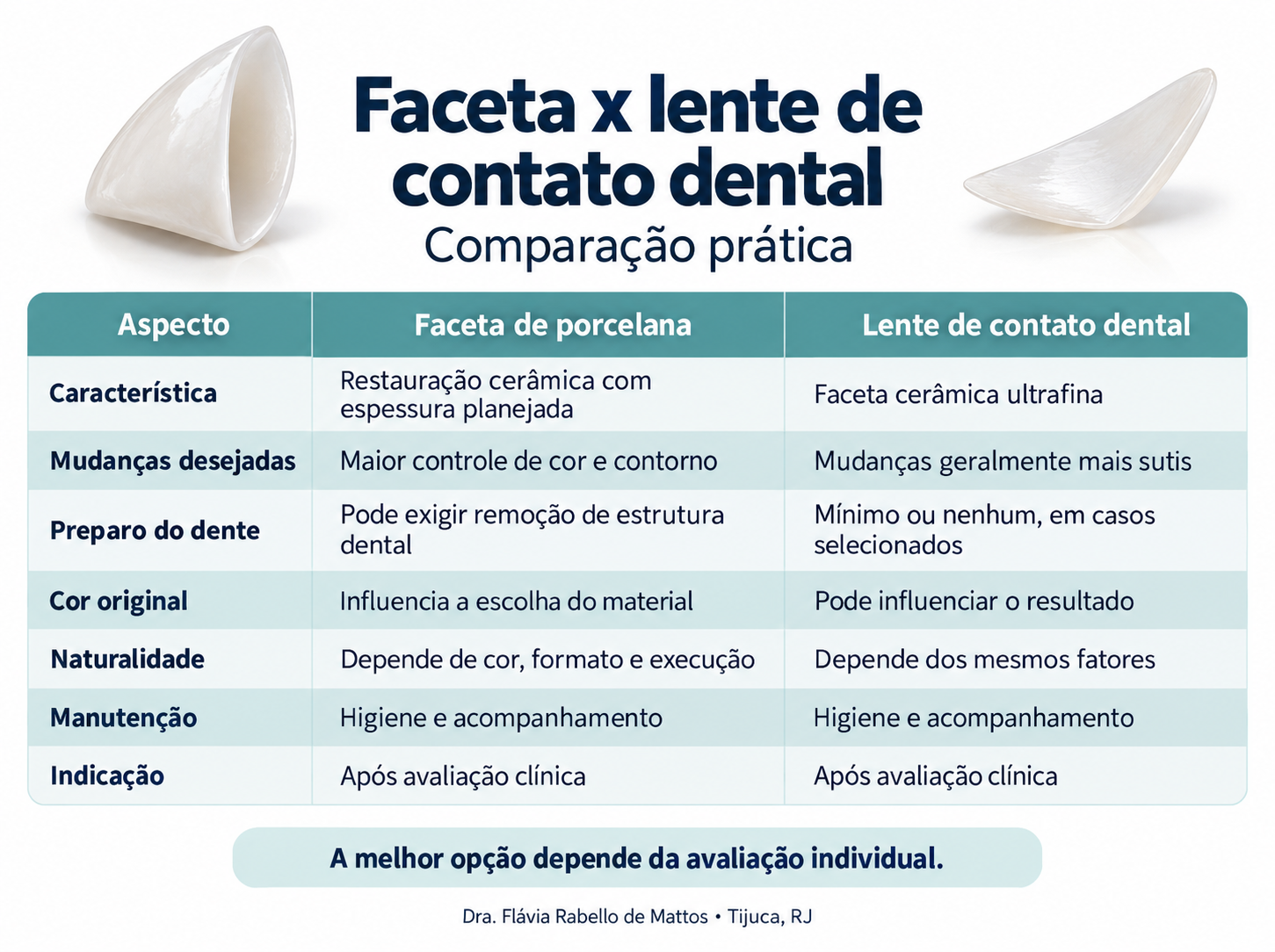 Comparação prática entre faceta e lente