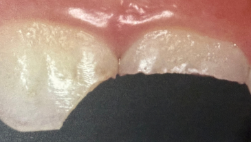 Emergência Dentária na Tijuca
