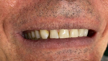 Dra Flávia Rabello de Mattos Sua Dentista na Tijuca RJ
